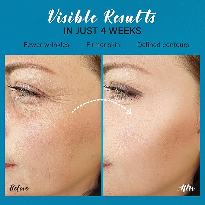 Tighten and Lift Neck Cream: Instant Face Lift Cream - 6-in-1 Anti-Aging Face Moisturizer for Anti-Wrinkle, Firm - Collagen, Retinol, Peptides & Hyaluronic Acid Neck Firming Cream for Skin Care-BrightBean Baby