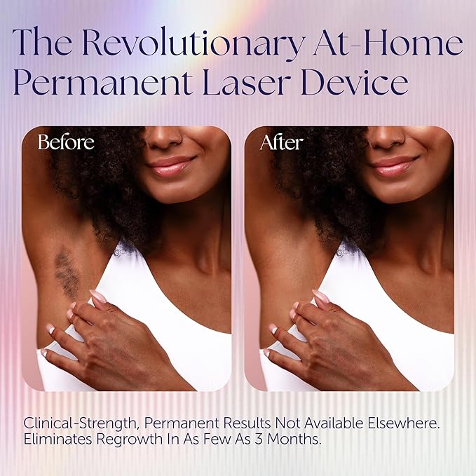 Epilaser At-Home Laser Hair Removal Device for Darker Skin, Safe, Intelligent, Clinical-Strength, Painless and Permanent Hair Removal for Face, Body, Bikini Line (Dark Skin)-BrightBean Baby