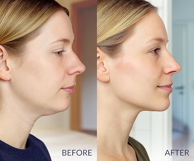 Stylia V Line Lifting Collagen Face Mask - Double Chin Strap for Women - Jawline Shaper Face Lift Tape - Neck Lift Collagen Mask - Chin Strap for Sleeping - Hyaluronic Acid, Aloe Vera, Cica 2PC-BrightBean Baby