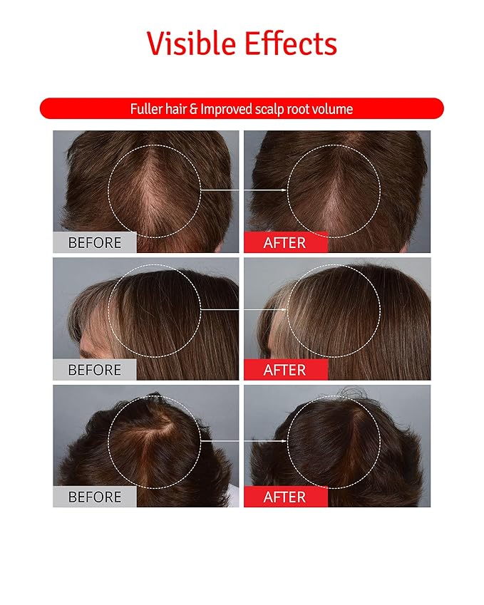 Scalp+ Shampoo for DHT Blocker, Hair Loss Relief - Moisture Anti-Aging Thickening Volumizing Fortifying & Repairing Hair Strength Fuller Hair with Vitamin C, Peptides, Biotin, 10.14 fl.oz.-BrightBean Baby