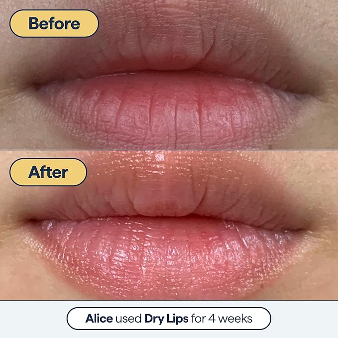 Remedy for Dry Lips - Hydrating and Healing Lip Balm Ointment with Ceramides, Peptides, and Dimethicone - Repairs Dry, Cracked Lips - By Dermatologist Dr. Shah-BrightBean Baby