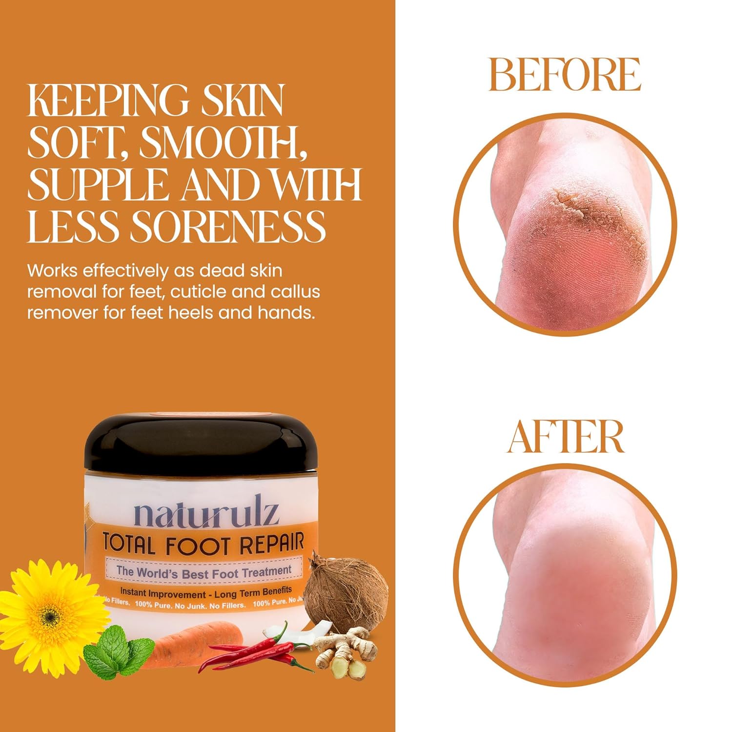 Naturulz Total Foot Repair 4oz – No Junk Foot Cream for Dry, Rough Skin & Cracked Heels, Lightweight & Compact Moisturizer for Feet, Knees, Elbows & Hands, Softens, Repairs & Smooths Cracked Skin-BrightBean Baby