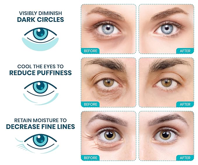 Stylia Under Eye Patches for Puffy Eyes and Dark Circles (6 Pairs) - Marine Collagen Under Eye Mask with Vitamin C, Hyaluronic Acid, Pearl Extract - Eye Masks for Dark Circles and Puffiness-BrightBean Baby