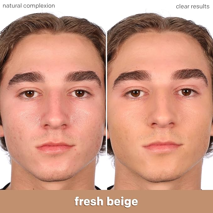 Almay Clear Complexion Acne Foundation Makeup with Salicylic Acid - Lightweight, Medium Coverage, Hypoallergenic, Fragrance-Free, for Sensitive Skin, 500 Fresh Beige, 1 fl oz.-BrightBean Baby