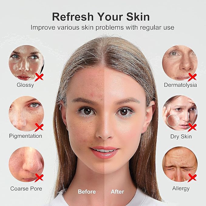 Newbealer Facial Steamer, Mini Aroma Face Steamer, Nano Ionic Hot Mist Facial Humidifier Atomizer, Home Sauna Spa Sprayer Moisturizing Cleansing Pores, 9 Pieces Acne Remover Kit (Pink-Gold, 160ml)-BrightBean Baby