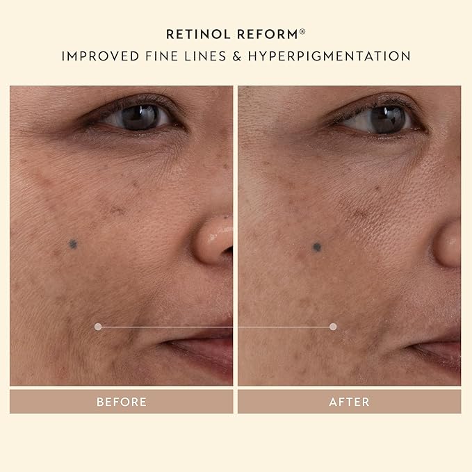 SHANI DARDEN SKINCARE Sculpt & Firm Travel Kit, Facial Sculpting Wand, Attachments, Retinol Reform & Lactic Serums, Peptide Cream & Pep Gel, 7 Items-BrightBean Baby