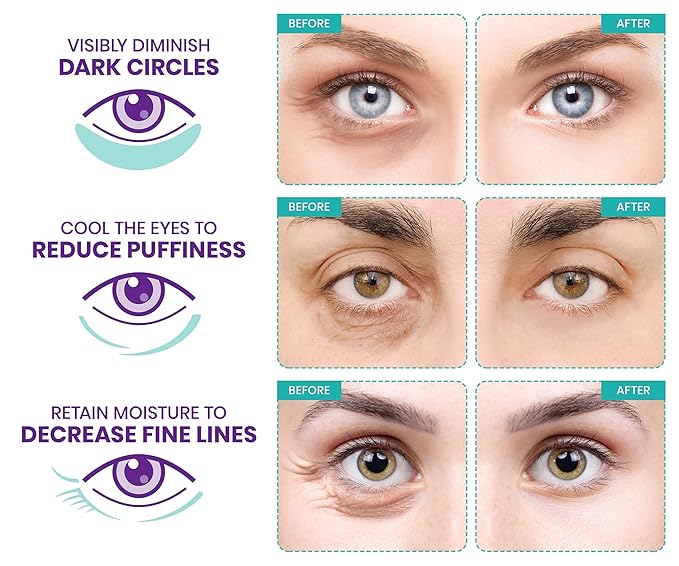 Stylia Under Eye Patches for Puffy Eyes and Dark Circles (6 Pairs) - Marine Collagen Under Eye Mask with Retinol, Vitamin C, Hyaluronic Acid, Pearl Extract - Eye Masks for Dark Circles and Puffiness-BrightBean Baby