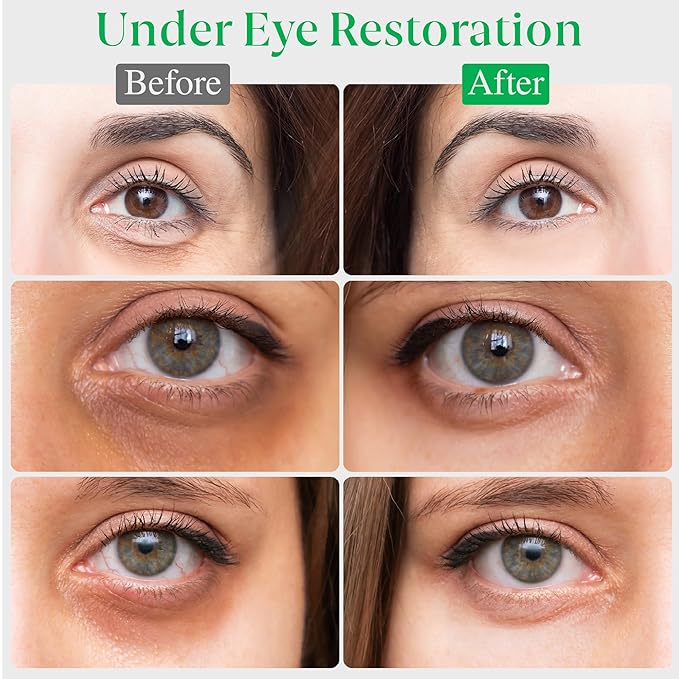 EyeGLO Caffeine Eye Cream for Dark Circles, Eye Bags, and Puffiness | Under Eye Treatment for Women with Peptides, Antioxidants, Hyaluronic Acid | Natural Brightening Eye Cream - 1 Oz-BrightBean Baby