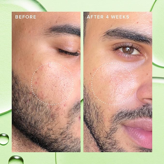 Farmacy 2% Salicylic Acid Toner for Face - Deep Sweep Gentle BHA Exfoliant for Oily Skin - Refines Texture with Papaya Enzymes & Moringa Water for a Healthy-Looking Complexion (100ml)-BrightBean Baby