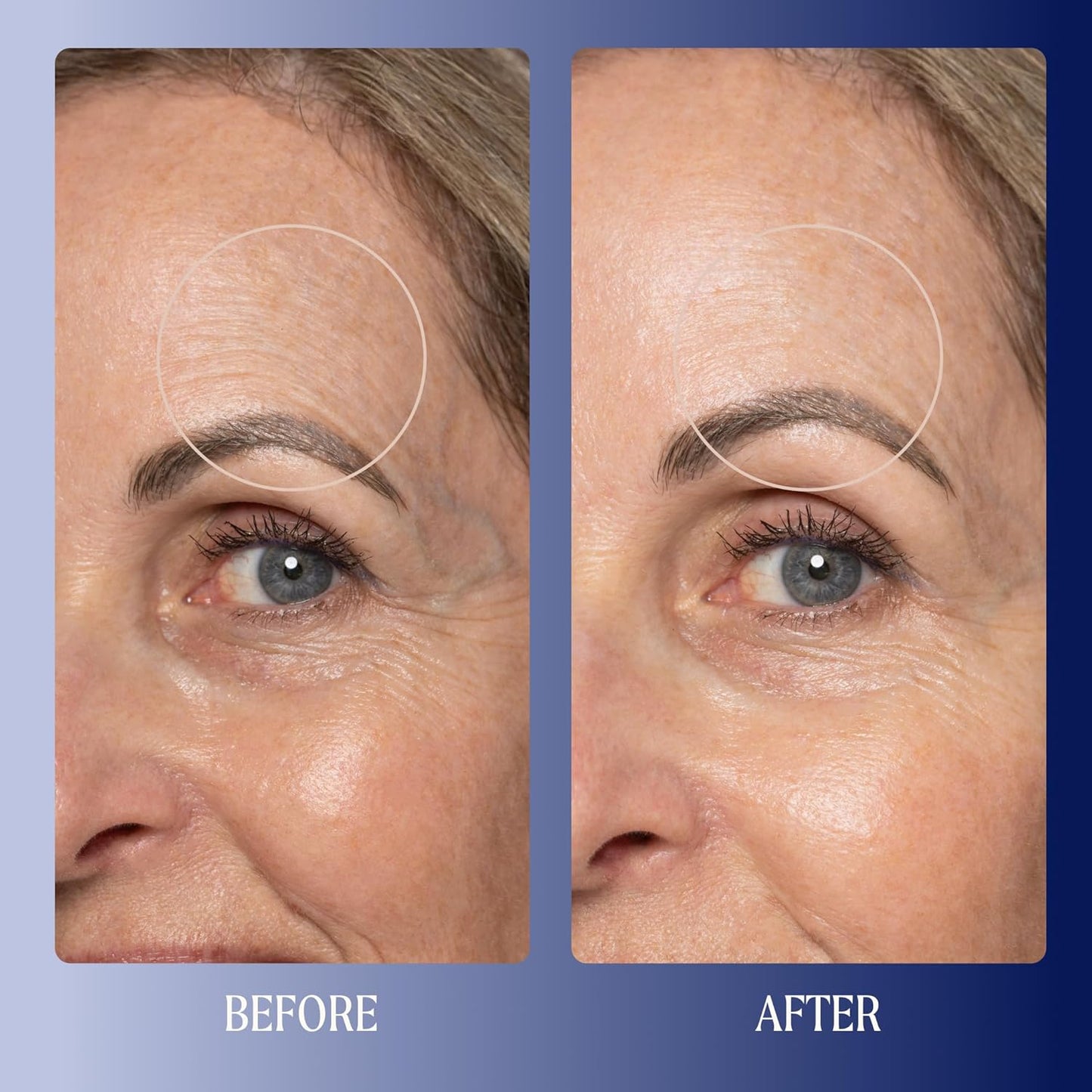 Kinship Super Rich Collagen + Ceramide Firming Cream | Anti Aging, Hydrating Face Moisturizer for Sensitive Skin | Wrinkle Cream - Smooth Fine Lines | Synthetic Fragrance-Free | Derm Approved, (1.7oz)-BrightBean Baby