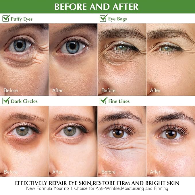 Under Eye Patches for Dark Circles: 30 Pairs Green Tea Eye Gels Pads - Reduce Eye Bags, Wrinkles & Puffy - Skin Treatment Mask Retinol Collagen - Anti Aging & Face Moisturizer For Women (Green Tea)-BrightBean Baby