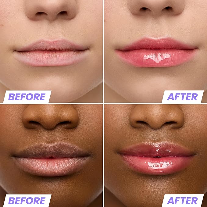 Wonderskin Lip Oil Rehab Serum - Tinted Lip Oil for Women, Hydrating, Moisturizing, and Non-Sticky Red Tint Serum for Dry Lips (Amour)-BrightBean Baby