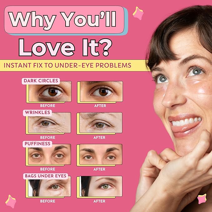 RevitalEyez Brightening Hydrogel Under Eye Patch with Niacinamide, Collagen & Rose Petals for Puffy Eyes, Wrinkles, Dark Circles (10 pairs)-BrightBean Baby