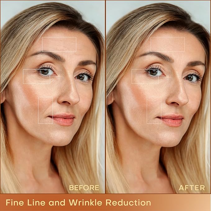 MLAY Professional RF Beauty Machine, Radio Frequency Face Machine with 2 Probes, at Home Radio Frequency Skin Tightening for Lifting, Wrinkle Reducing, Anti Aging - Salon Effects（Gel Included）-BrightBean Baby