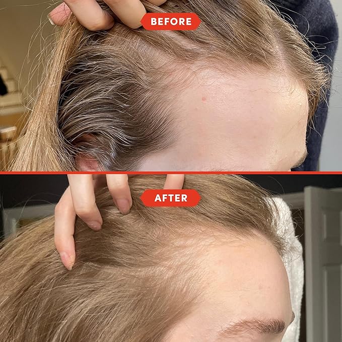 Fable and Mane Hair Oil - HoliRoots Strengthening Serum for Damaged, Frizzy Hair with Amla, Castor Oil for Hair Health - 3.4FL oz-BrightBean Baby