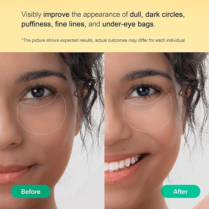 TEREZ & HONOR Vitamin C Eye Patches - 60 Pcs Korean Brightening & Hydrating Under Eye Masks with Tranexamic Acid, Caffeine, Hyaluronic Acid - Dark Circles, Puffiness & Wrinkles Hydrogel Treatment-BrightBean Baby