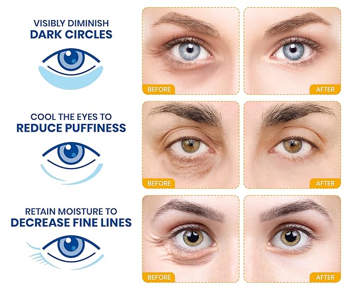 Stylia Under Eye Patches for Puffy Eyes and Dark Circles (30 Pairs) - 24k Gold Under Eye Mask with Vitamin C, Hyaluronic Acid, Pearl Extract - Eye Masks for Dark Circles and Puffiness-BrightBean Baby