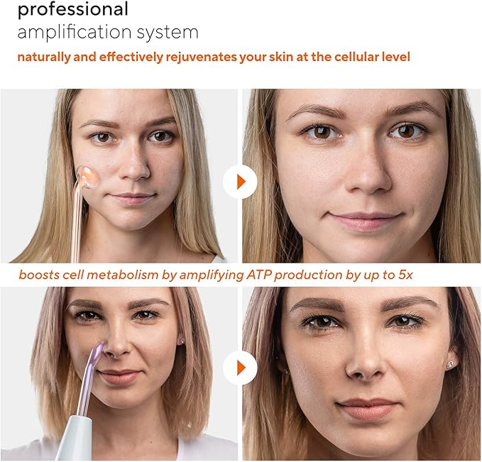 NuDerma Professional Skin Therapy Wand - Portable Skin Therapy Machine with 6 Neon & Argon Wands – Boost Your Skin – Clear Firm & Tighten-BrightBean Baby