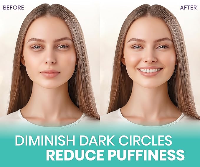 Stylia Under Eye Patches for Puffy Eyes and Dark Circles (30 Pairs) - Marine Collagen Under Eye Mask with Retinol, Vitamin C, Hyaluronic Acid, Pearl Extract - Eye Masks for Dark Circles and Puffiness-BrightBean Baby