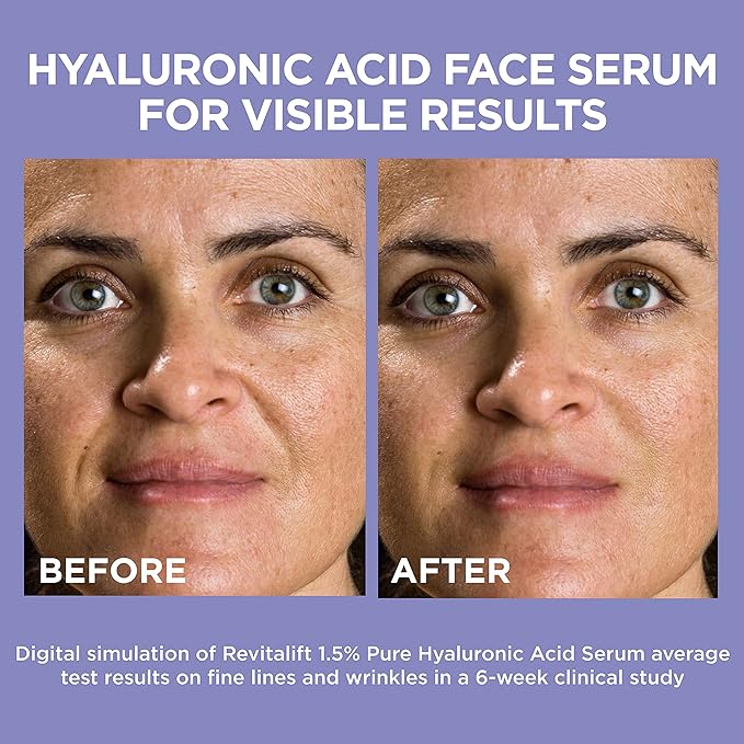 L'Oreal Paris Revitalift 1.5% Pure Hyaluronic Acid Face Serum 1.0 oz + True Match Lumi Glotion Natural Glow Enhancer Lotion, Medium 1.35 fl. oz, 1 kit-BrightBean Baby