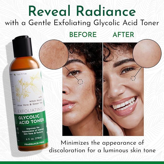 Tree To Tub Glycolic Acid Toner for Face w/Witch Hazel & Hydrating Aloe Vera for Smooth Skin - Minimizes Appearance of Fine Lines & Brightens - Vegan Exfoliating Toner for Women & Men-BrightBean Baby