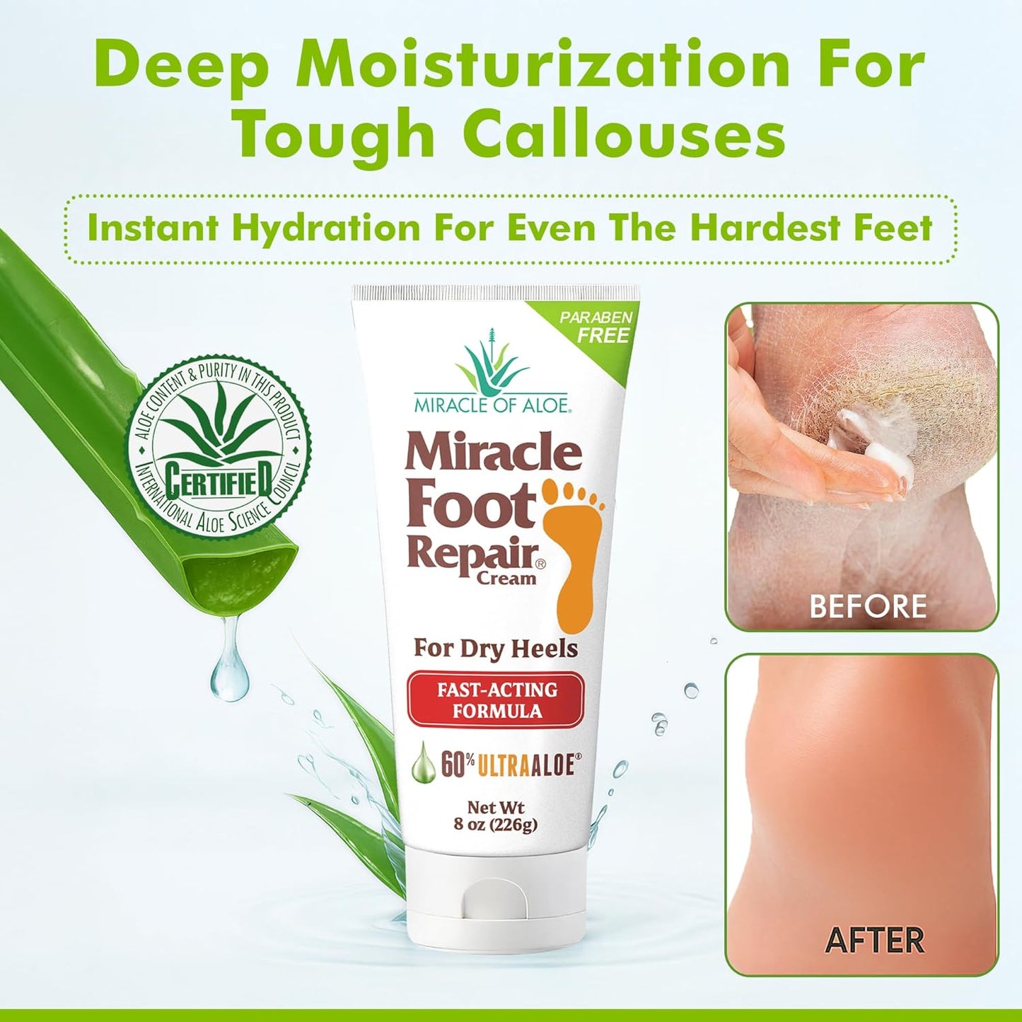 Miracle Foot Repair Cream (8 oz / 2-Pack) Repairs Dry Cracked Heels and Feet, 60% Pure UltraAloe Moisturizes, Softens, and Repairs-BrightBean Baby