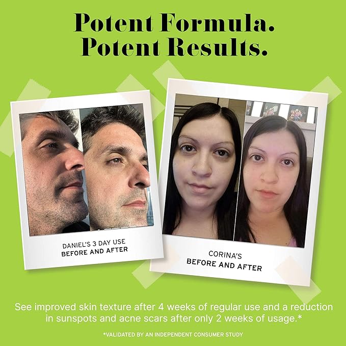 No B.S. Caffeine Eye Cream with Pure Hyaluronic Acid & Plant Based Squalane Oil, Under Eye Cream for Dark Circles & Puffiness, Skin Care for Women & Men, Travel Size, 0.5 FL Oz, and CoQ10 for Wrinkles-BrightBean Baby