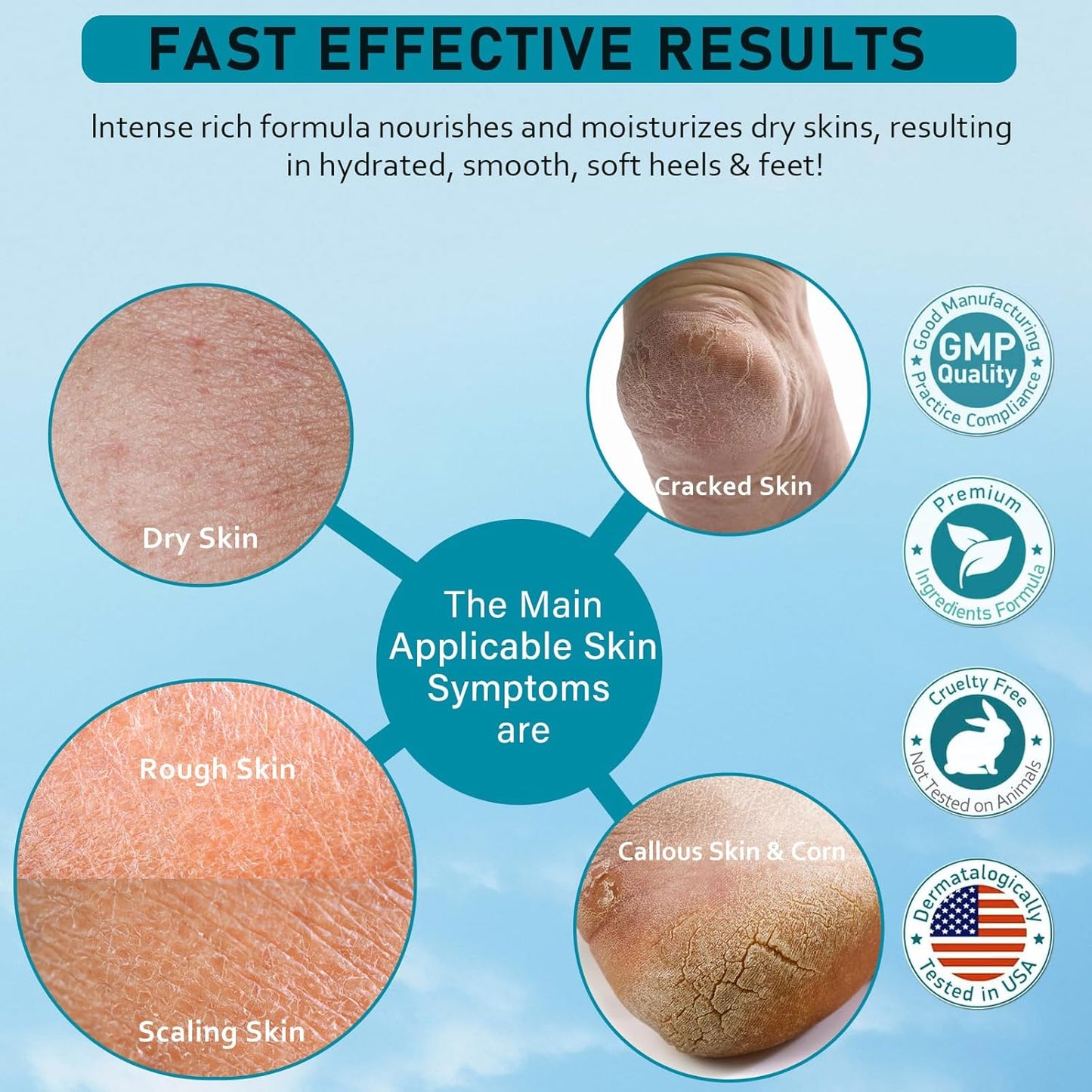 Urea Cream 40 Percent For Feet Maximum Strength - plus Salicylic Acid 2% Foot Cream For Dry Cracked Heels Feet Knees - Dead Skin Cuticle Callus Remover Toenail Softener - Pack of 2-BrightBean Baby