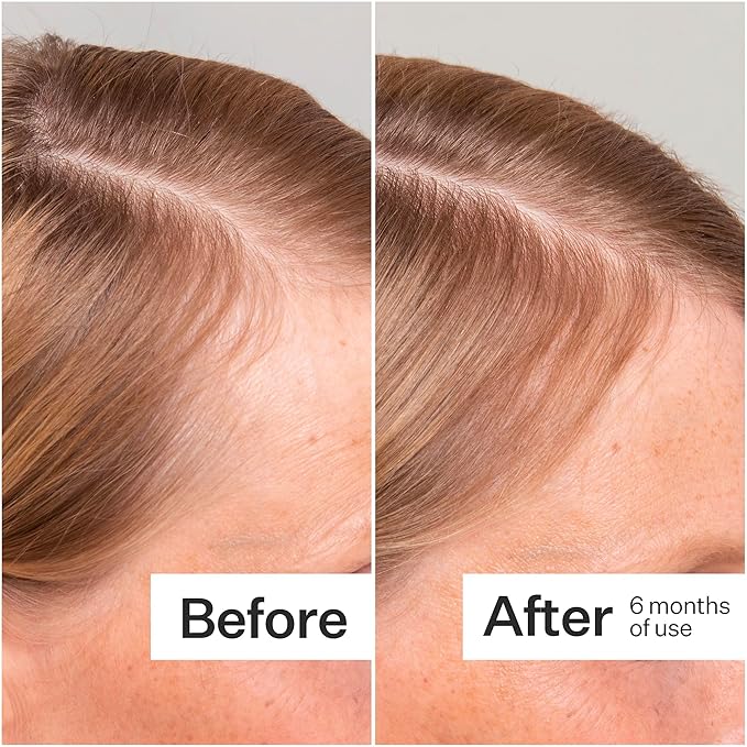 Act+Acre 3-Pack Mini Cold Processed Stem Cell Scalp Serum - Promotes Thicker, Fuller-Looking Hair - Soothes and Hydrates - Sulphate and Paraben Free - Aloe Vera for Improved Scalp Health-BrightBean Baby