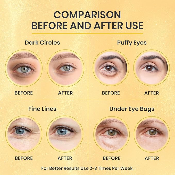 24k Gold Under Eye Patches for Puffy Eyes (7 Pairs) – Gold Foil Under Eye Masks for Dark Circle with Betaine, Hyaluronic Acid – Skincare Eye Bags Patches Treatment for Men & Women-BrightBean Baby