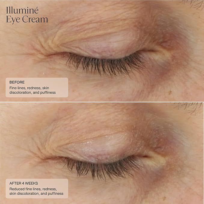 Senté Illuminé Eye Cream | Diminish Dark Circles, Discoloration, Redness, and Puffiness Around The Eyes | with Patented HSA, Niacinamide and Peptides | 0.5 Oz-BrightBean Baby