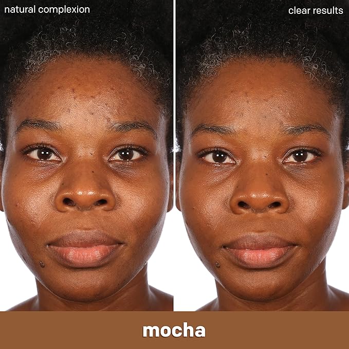Almay Clear Complexion Acne Foundation Makeup with Salicylic Acid - Lightweight, Medium Coverage, Hypoallergenic, Fragrance-Free, for Sensitive Skin, 900 Mahogany, 1 fl oz.-BrightBean Baby
