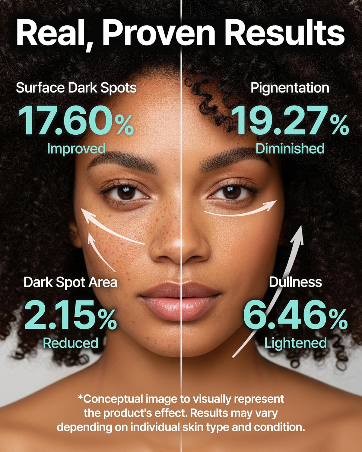 Charde Niacinamide 25% Snow Ampoule for Face, Dark Spot Care for Hyperpigmentation, Freckles & Sun Spots | Radiance Boosting with White Garcinia & Arbutin, Korean Skin Care, 1.01 fl. oz.-BrightBean Baby