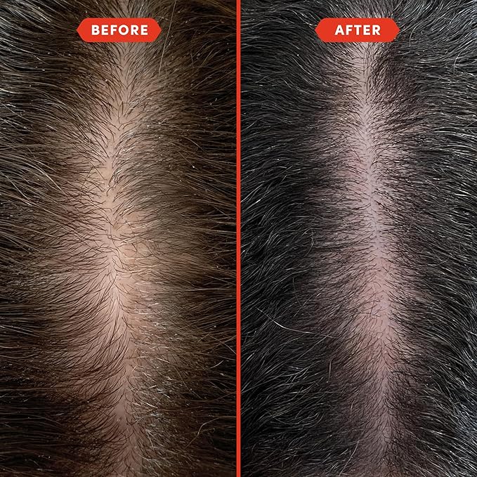 Fable and Mane Hair Oil - HoliRoots Strengthening Serum for Damaged, Frizzy Hair with Amla, Castor Oil for Hair Health - 3.4FL oz-BrightBean Baby